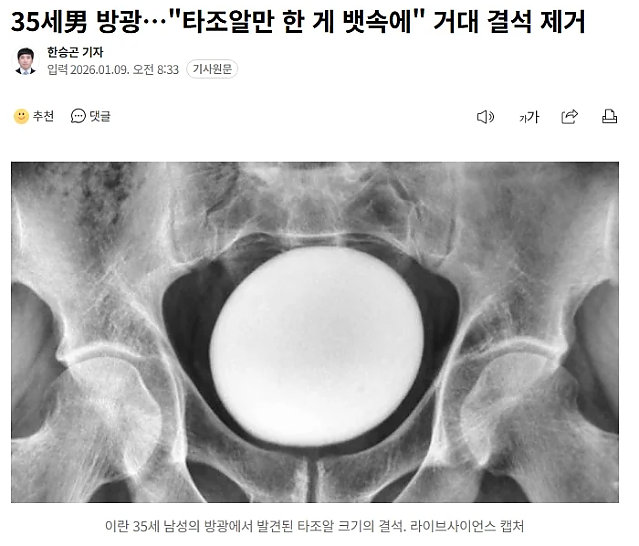 박혁거세 설화의 진위여부