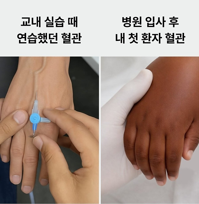 간호사 연습과 실전차이