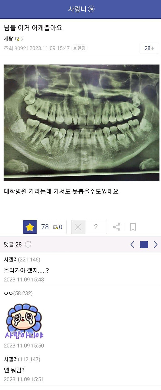 사랑니 갤러리 갤주
